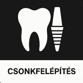 Csonkfelépítés
